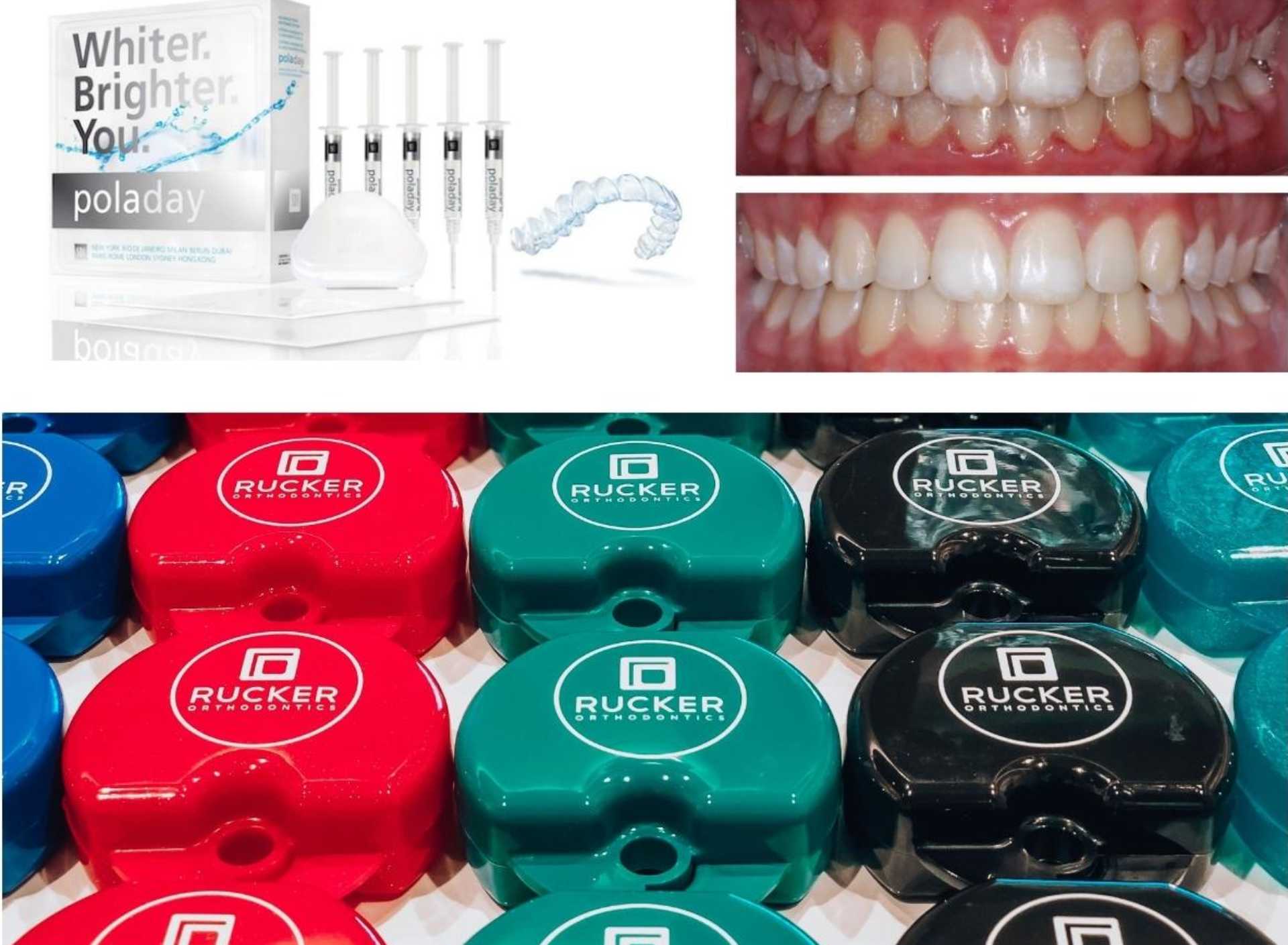 Rucker Orthodontics – Temecula and Murrieta Invisalign and braces specialist
